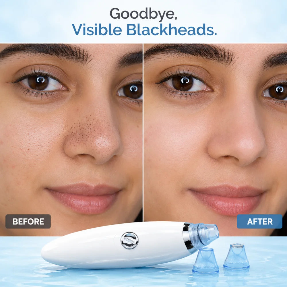 MEON Glycolic Acid Serum – Dark Spot Fade & Even-Tone Brightening Treatment
